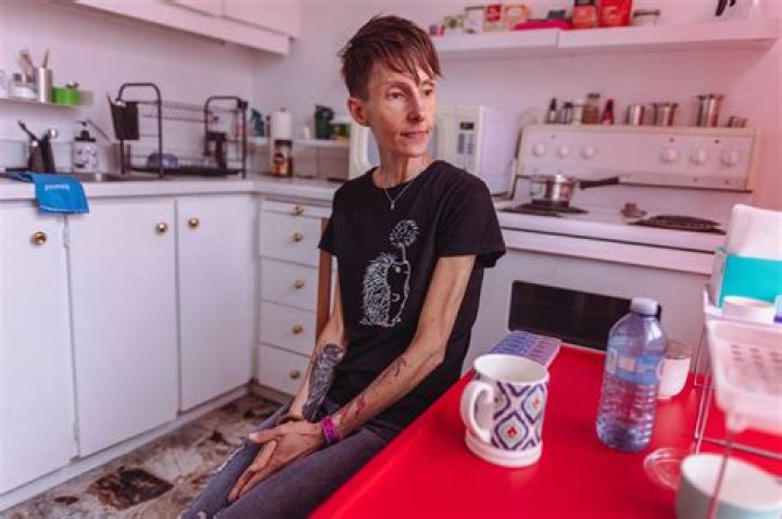 Anorexic Woman Canada | Who Is Lisa Pauli | Why Is She Pleading For Death