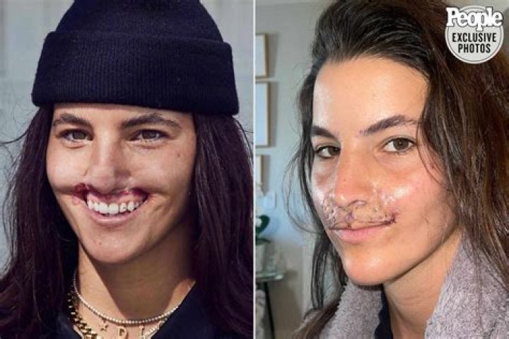 Ashley Leechin Plastic Surgery Before And After: What Is Wrong With Her Face?	