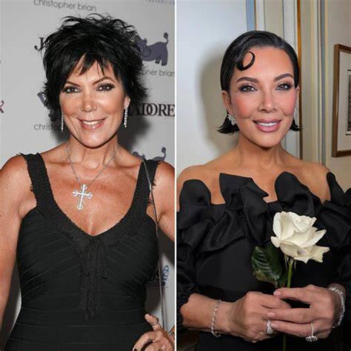 Chelsea Lazkani Plastic Surgery | Before And After Photos