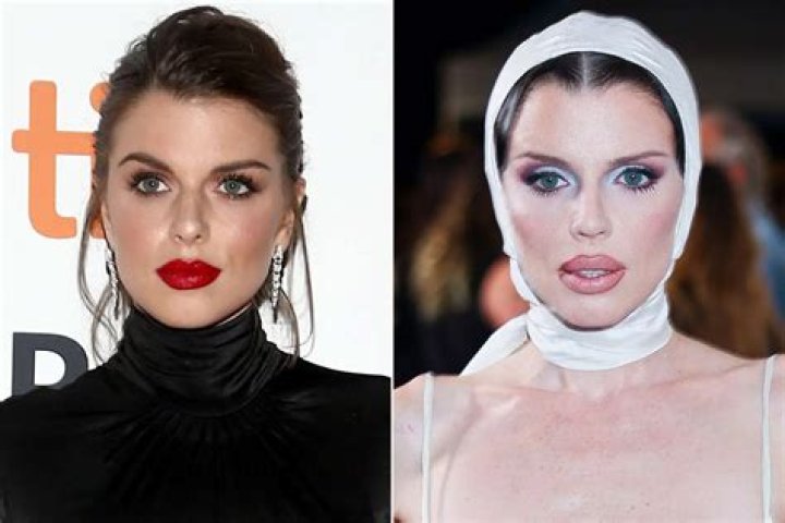 Maddymorebucks Before Surgery | Did She Have A Nose Job