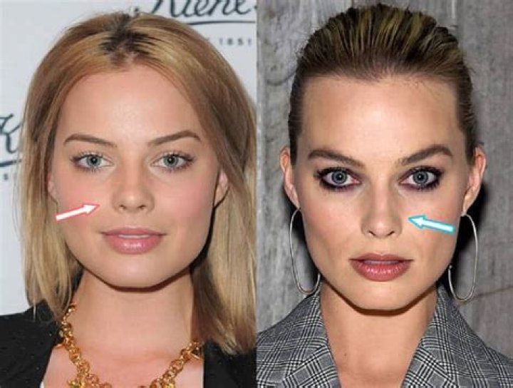 Margot Robbie Botox And Nose Job – Did She Get Surgery? Before And After