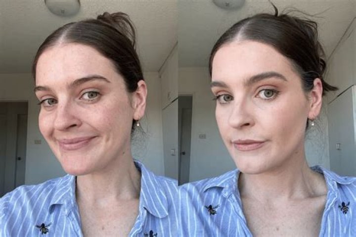 Meredith Duxbury Plastic Surgery | Before And After Photos