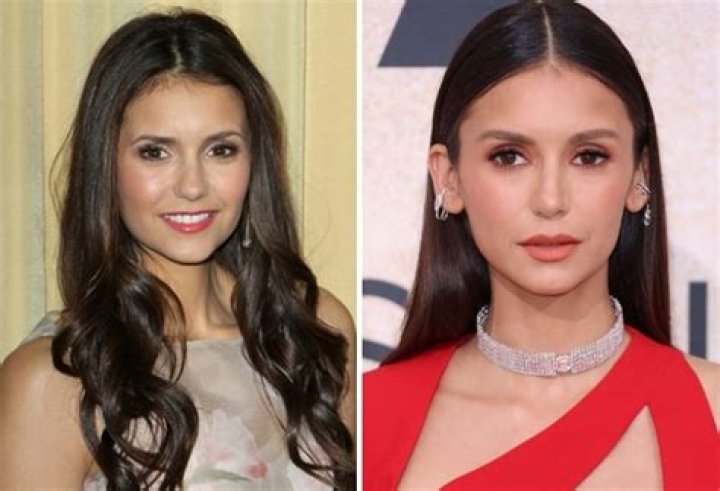 Nina Dobrev Weight Loss | What Happened To Him | Health Update